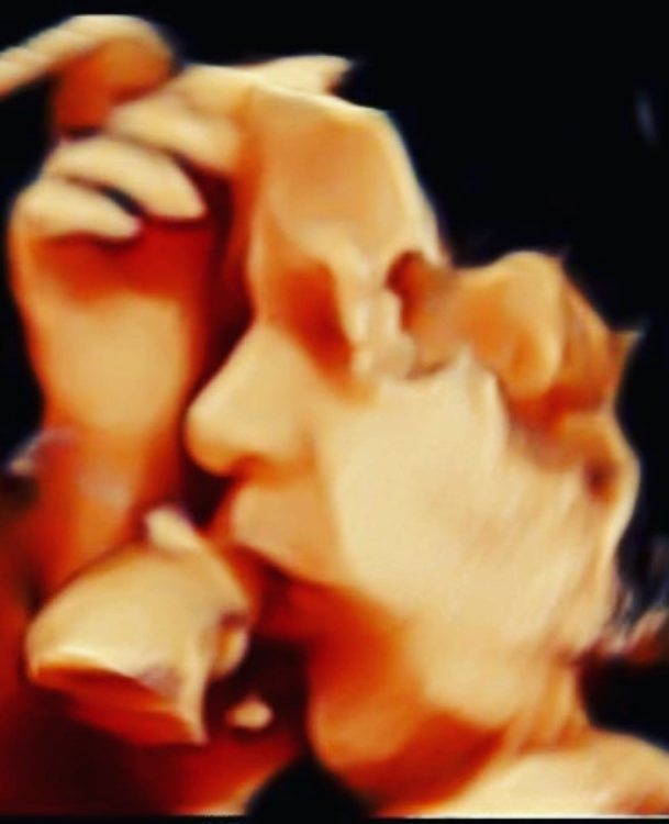 3D ultrasound of a baby’s profile with their hand raised