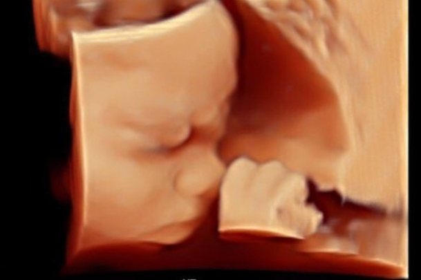4D ultrasound showing a baby’s hand near their face